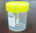 labeled Stool container/ stool cup with screw cup