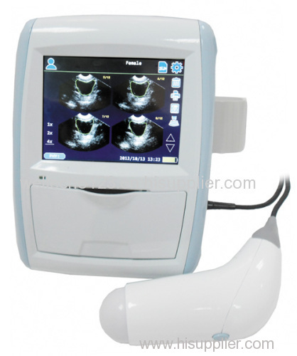 CareScan-1 ultrasound bladder scanner