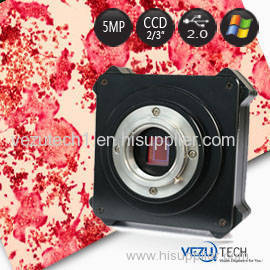 5Mp CCD Microscope Camera for Scientific Research