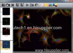 VIMAGE Lite/ Pro, Microscopy Imaging Software, Metallurgical Analysis