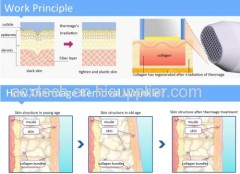 Fractional RF Radio Frequency Skin Lifting Device