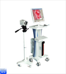 Durable electronic video colposcope