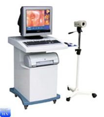 Durable electronic video colposcope