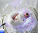 Infant Phototherapy Unit for hospital