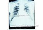 Low Fog Dry Medical Imaging Film KND-A / KND-F For Thermal Printers