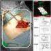 Surgery Operation Drapes Surgical Film Sterile Polyurethane Film 15*20cm