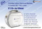 High - Tech Laser Q-Switch 1064 Nd Yag Laser Tattoo Removal Machine