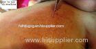 epilator ipl hair removal and spider vein removal machine, China IPL hair removal machine