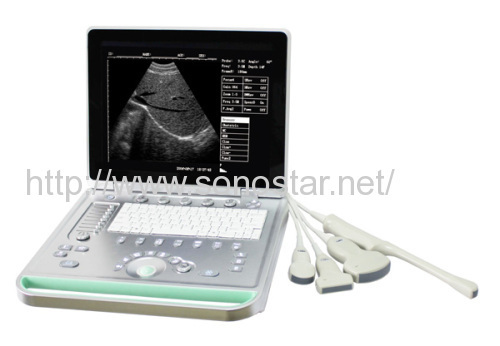 SS-7 Ultrasound B Scanner