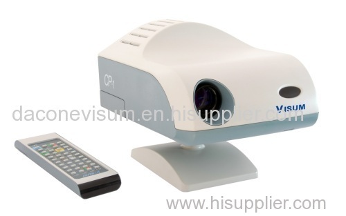Auto Chart Projector matching with Vision Chart