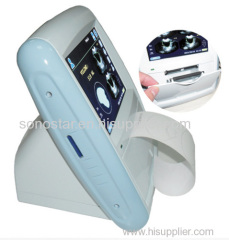 CareScan-1 ultrasound bladder scanner