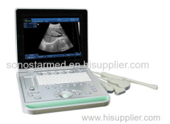 3D Digital Ultrasound PC based