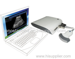 Full Digital Ultrasound Box