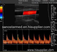 Color Doppler Ultrasound with Touch Screen