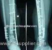 medical x-ray film silver halide film