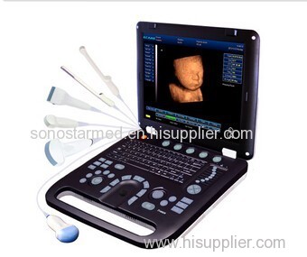 4D Laptop ultrasound Scanner