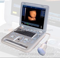 4D ultrasound scanner machine