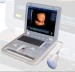 4D Laptop ultrasound Scanner