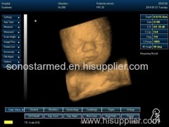 4D ultrasound scanner machine