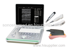 SS-7 laptop ultrasound machine