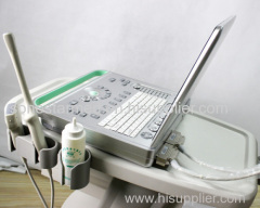 Laptop digital ultrasound Scanner