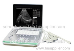 Laptop digital ultrasound Scanner