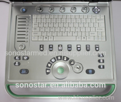 Laptop digital ultrasound Scanner