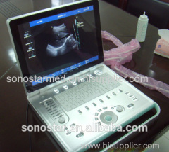 Laptop digital color doppler ultrasound