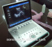 C5 laptop color doppler ultrasound system