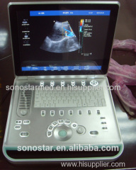 Laptop digital color doppler ultrasound