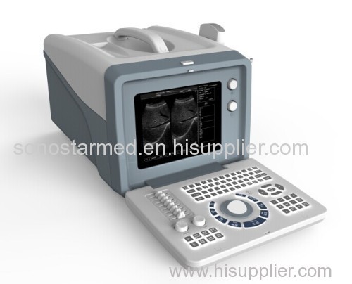 Portable Digital Ultrasound Scanner
