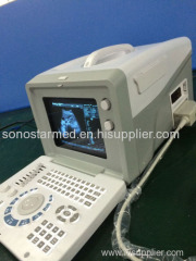 Portable Ultrasound Scanner Machine