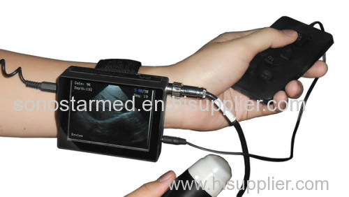 Veterinary wrist ultrasound scanner