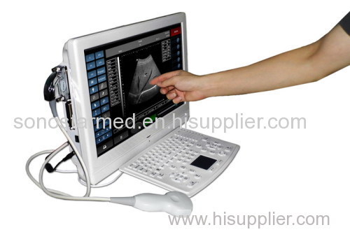 Touch Screen Ultrasund PC based system