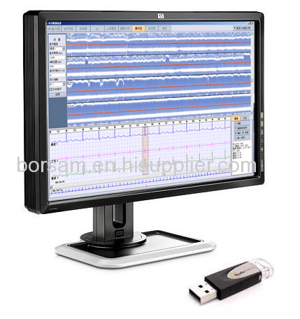 Holter ECG Analysis Software System Workstation BORSAM