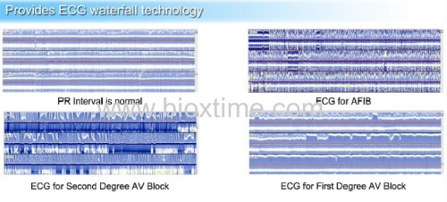 BORSAM ECG Holter Recorder