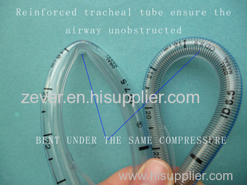 Reinforced endotracheal tube ( plain or cuffed)