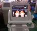 HIFU Face lifting High Intensity Focused Ultrasound Skin rejuvenate double chin removal