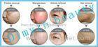 Double Handle IPL Beauty Equipment Skin Rejuvenation And Hair Removal Fast