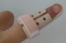 useful medical finger splint