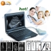 B/W small isze laptop Obstetrics ultrasound/palm size small ultrasound with high image quality