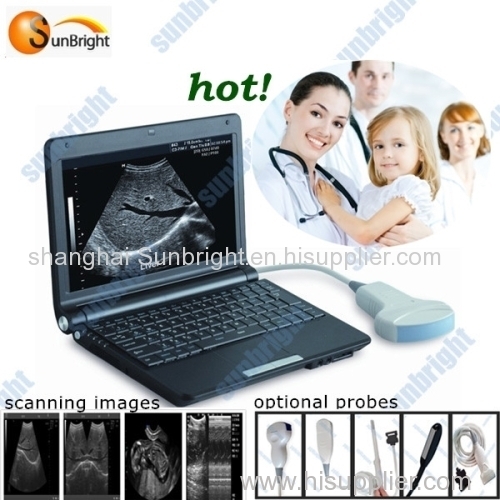 B/W laptop small size ultrasound with high image quality