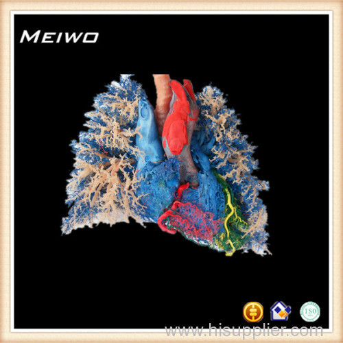 Heart -lung vascular casting specimens