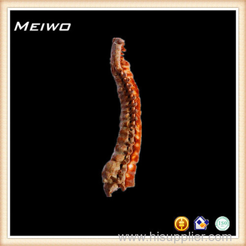 Median sagittal section of vertebral volumn plastinate