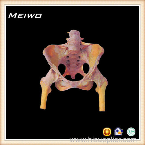 Hip joint with pelvis plastinated organ