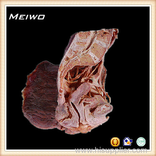 Median saggital section of female pelvis cavity plastination