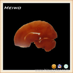 Sagittal section of brain Transparent slice