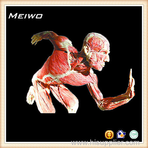 Spinning flywheel plastination of bodies