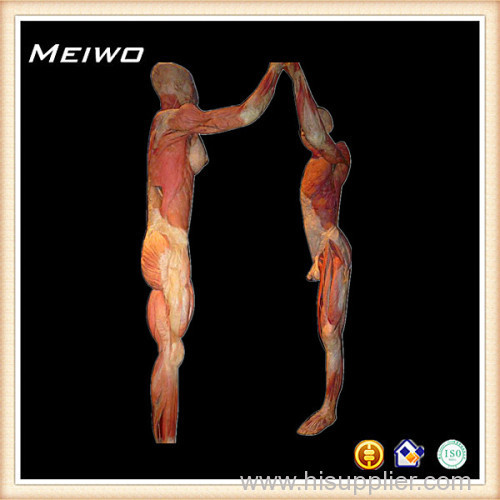 High-five posture plastinated specimens plastinated specimens price