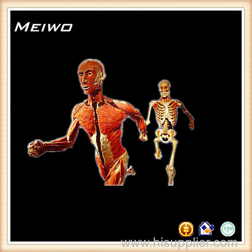 Runners in relay race posture plastinated cadaver
